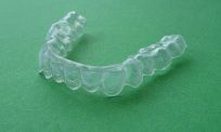 Die Therapie mit In-Line®-Schienen ist eine nahezu transparente und zugleich schonende Zahnkorrektur.